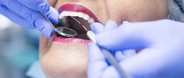 Best Dental Abscess Treatment in York, NE